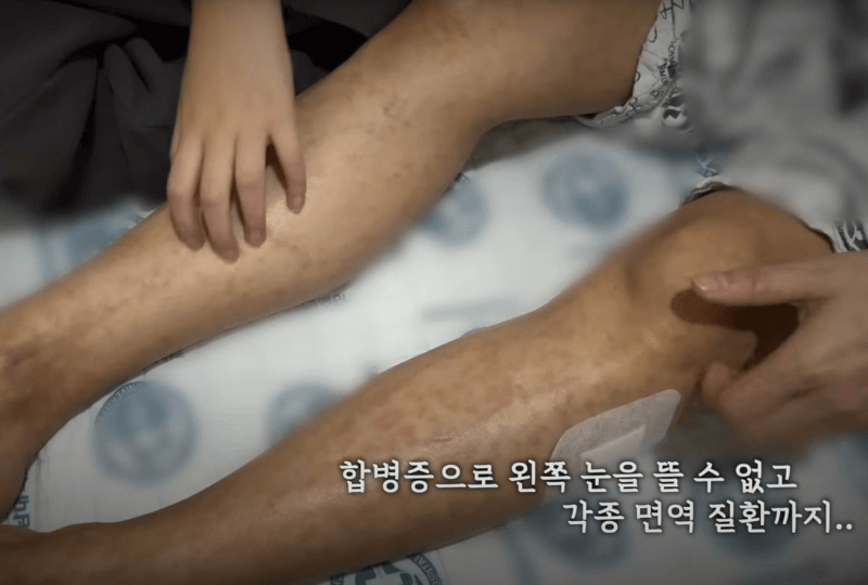 합병증이 생기는 희수 엄마