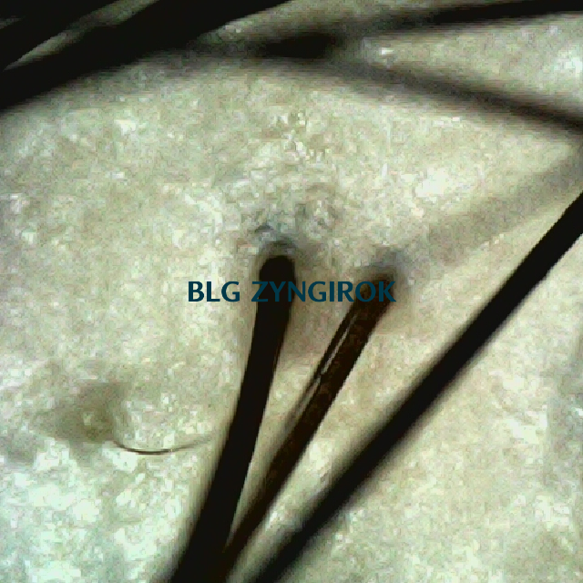 탈모 극복 프로젝트 - 정수리 두피 모습이다.