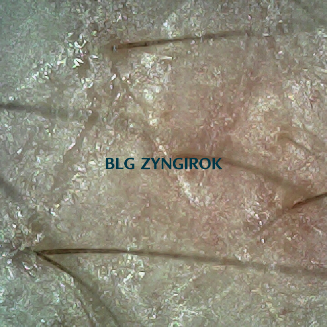 탈모 극복 프로젝트 - 오른쪽 M자 부위 두피 모습이다.