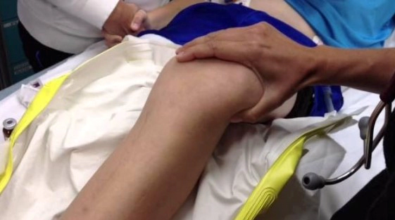 슬개골 탈구 수술