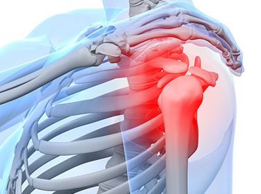 회전근개 어깨통증 세라밴드운동 어깨운동 오십견 어깨재활 근육강화 통증관리 자가치료 물리치료