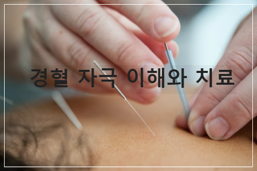 경혈 자극의 효과적인 이해와 치료