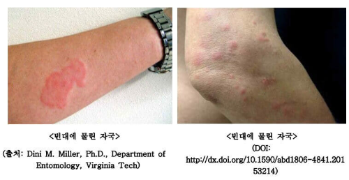 빈대 찾는 법-질병관리청