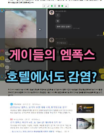  엠폭스 감염 경로