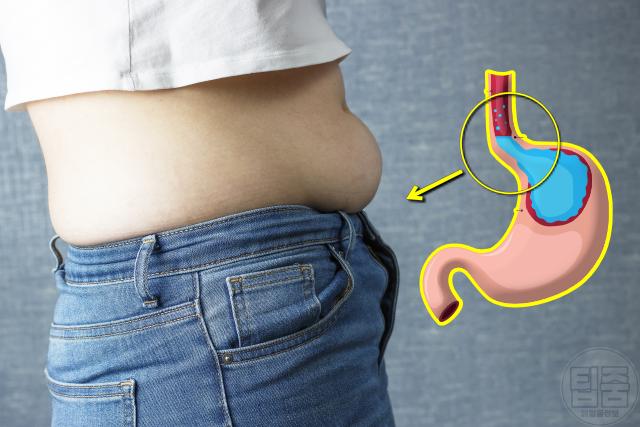 역류성식도염 자가치료 복부압박