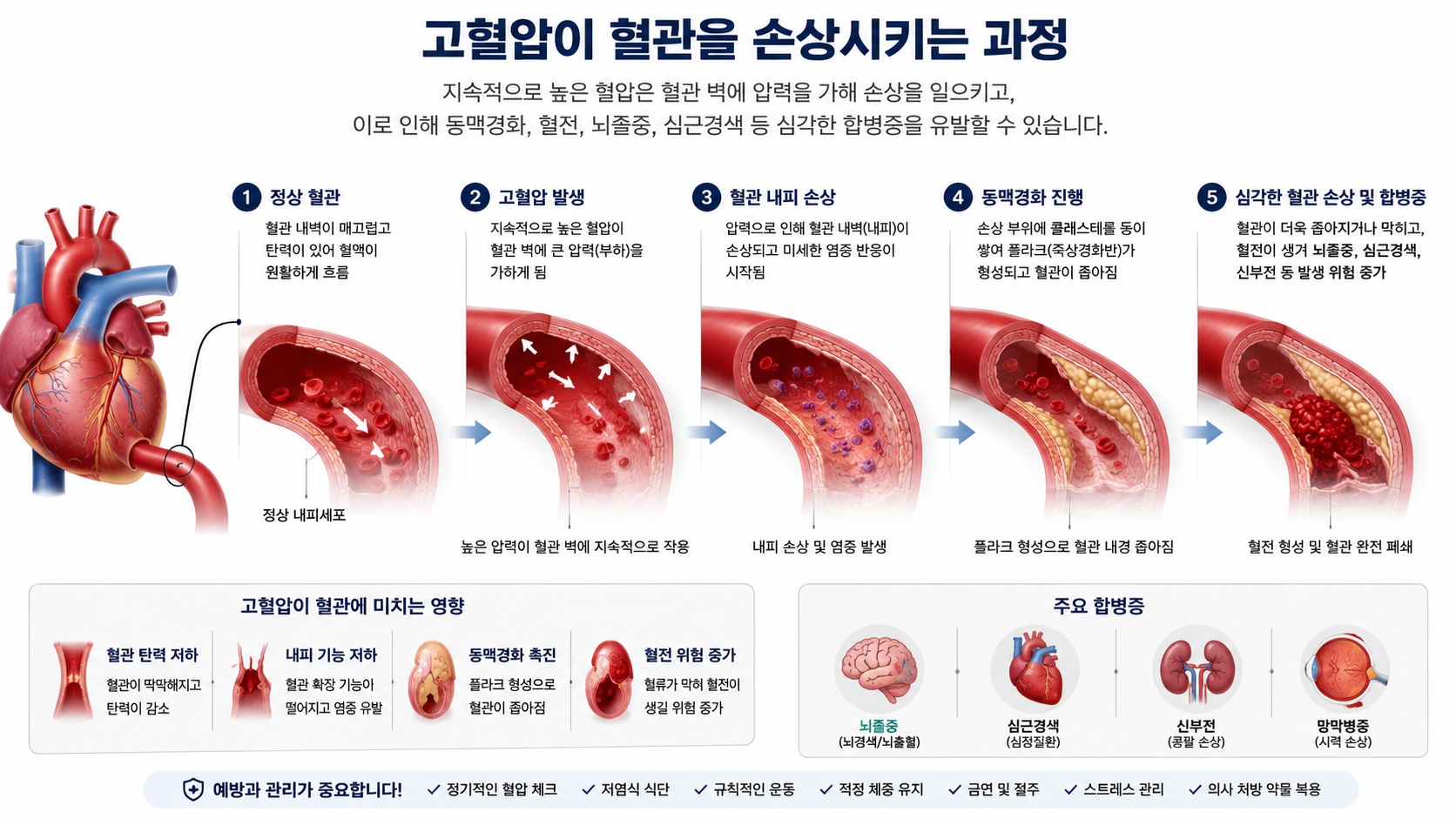 고혈압이 위험한 이유 7가지