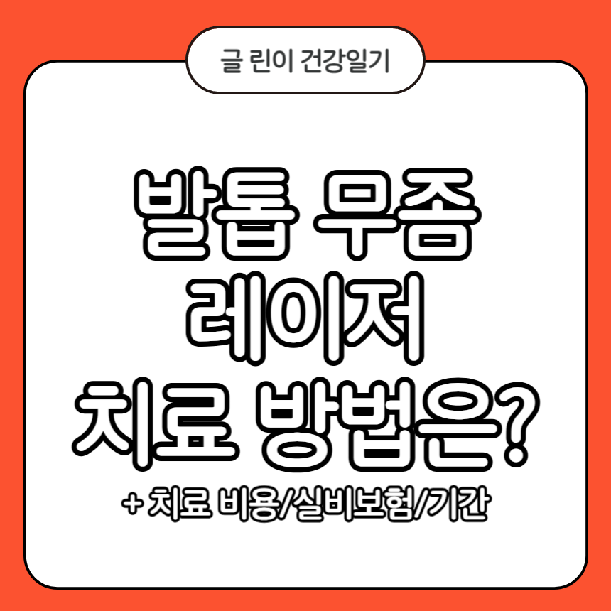 발톱 무좀 레이저 치료