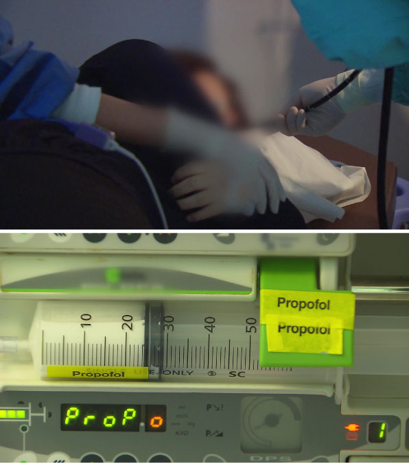 수면내시경 약물 투여하는 모습