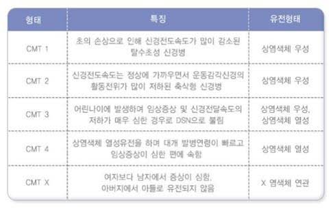 유전성 운동 및 감각 신경병증(HMSN, 샤르코-마리-투스병) 원인·증상·치료 총정리