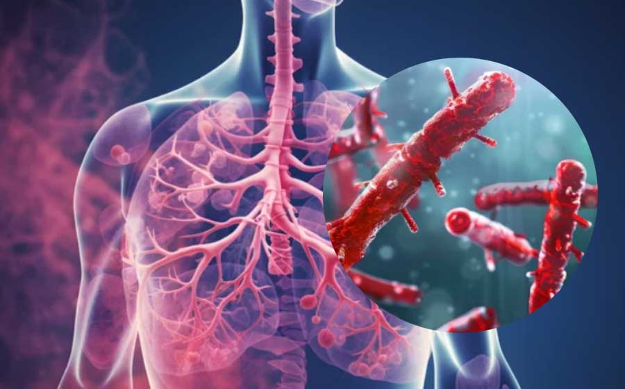 결핵 검사방법 (흉부 X-ray, 객담 검사, 혈액 검사)