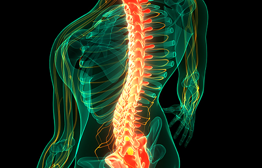 허리디스크 증상