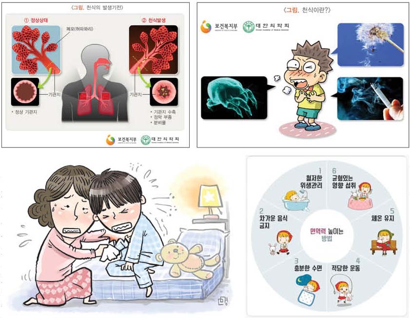 호흡기 질환: 천식- 주요증상, 종류, 자가진단 방법, 치료법