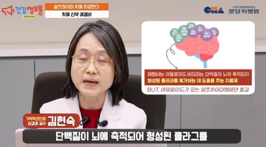 알츠하이머-치매-원인-레켐비