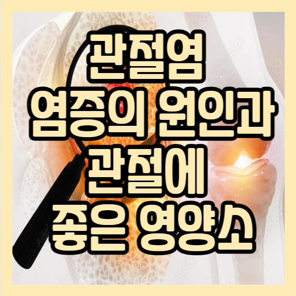 관절염 염증의 원인과 관절에 좋은 영양소