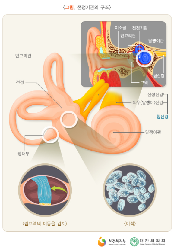 어지러움증증상