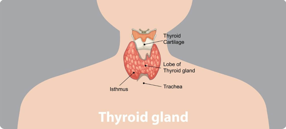 갑상선암 위치와 설명