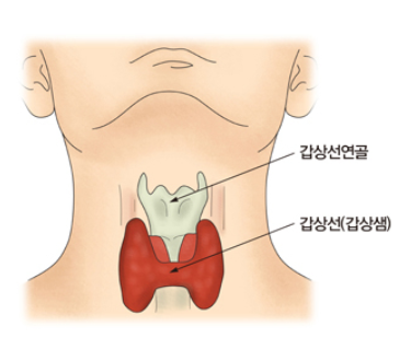 갑상선기능저하증