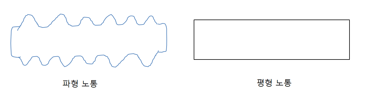 노통 종류 파형과 평형노통