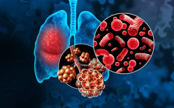 질병 독감 관련주 수혜주