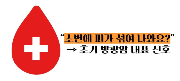 방광암 초기증상