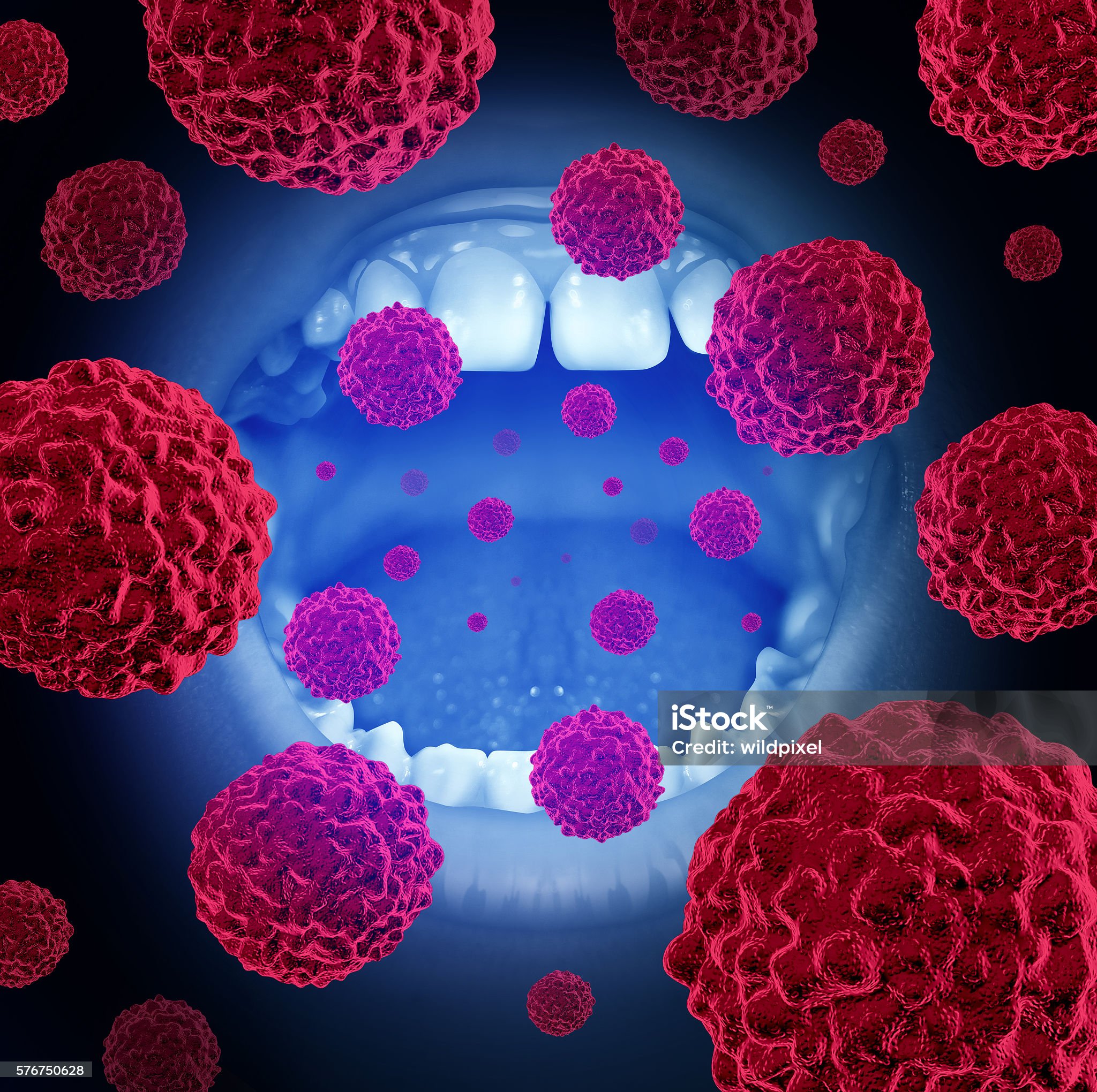 구강암-관련-사진