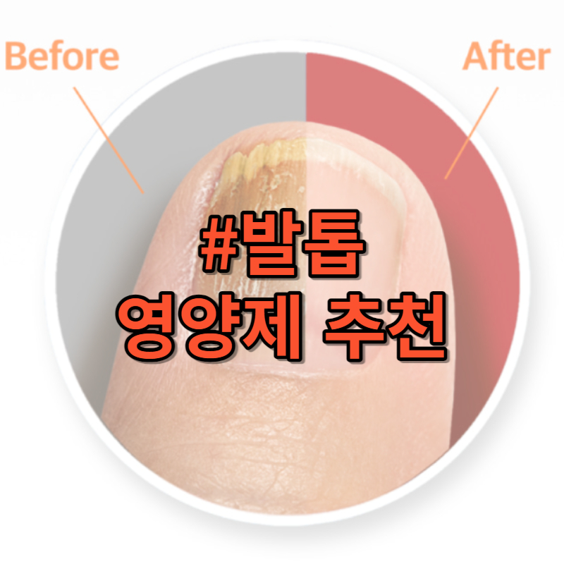 발톱 영양제 추천