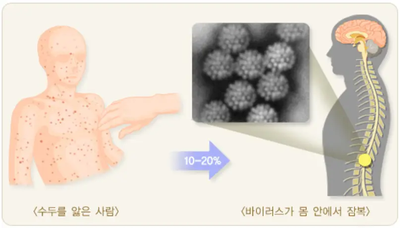 대상포진-증상이-어떻게-생기는지-설명되어-있는-질병관리청의-자료