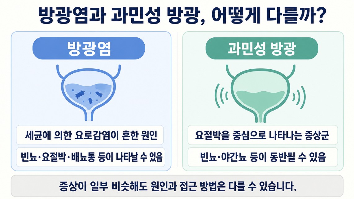 방광염과 과민성 방광의 원인과 주요 증상 차이 비교