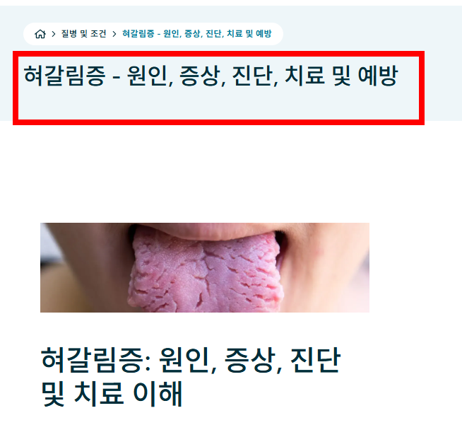혓바닥이 갈라지는 이유 알아보기
