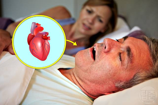 코골이 고치는법 코골이방지 수술 치료