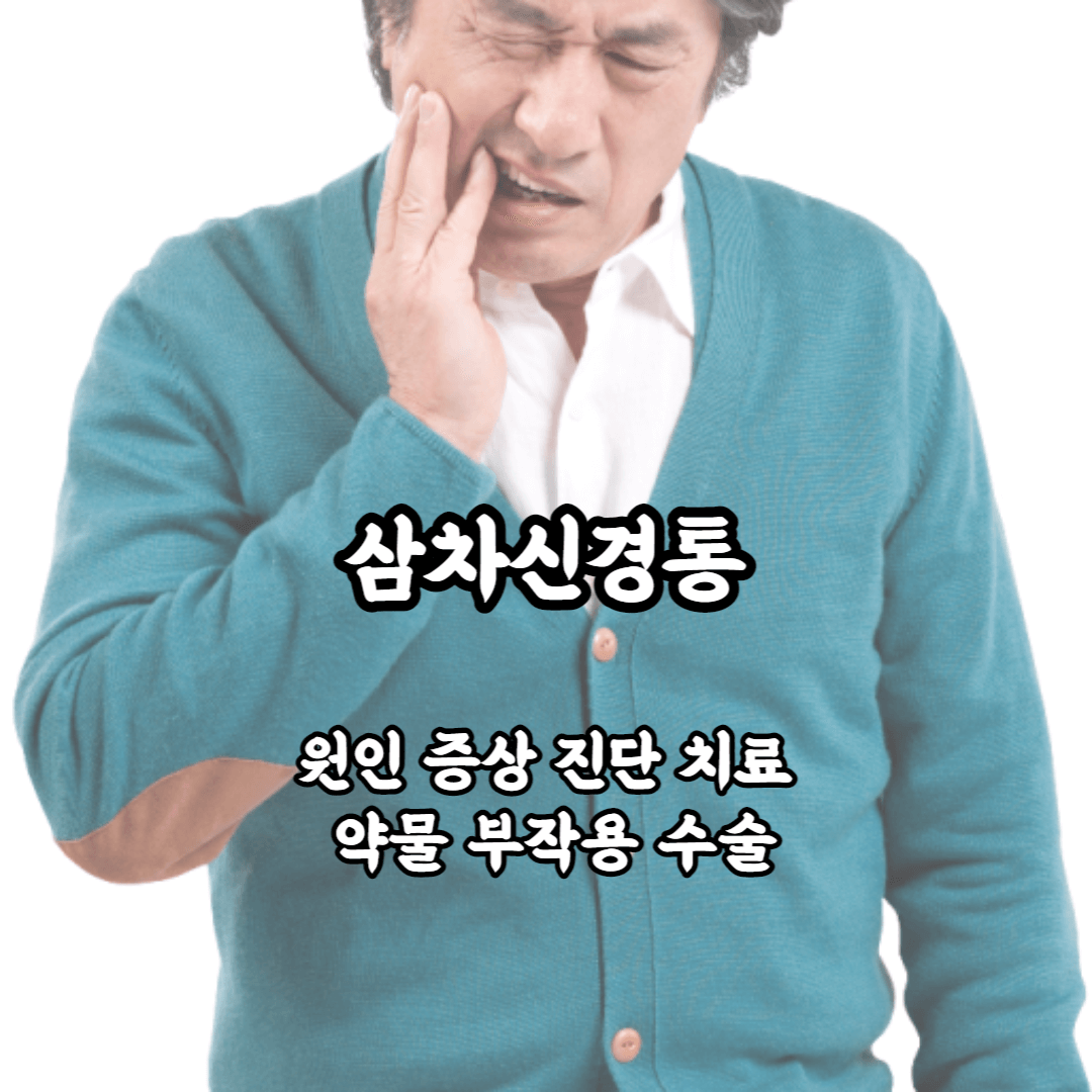 삼차신경통 원인 증상 진단 치료 약물 무작용 수술 병원