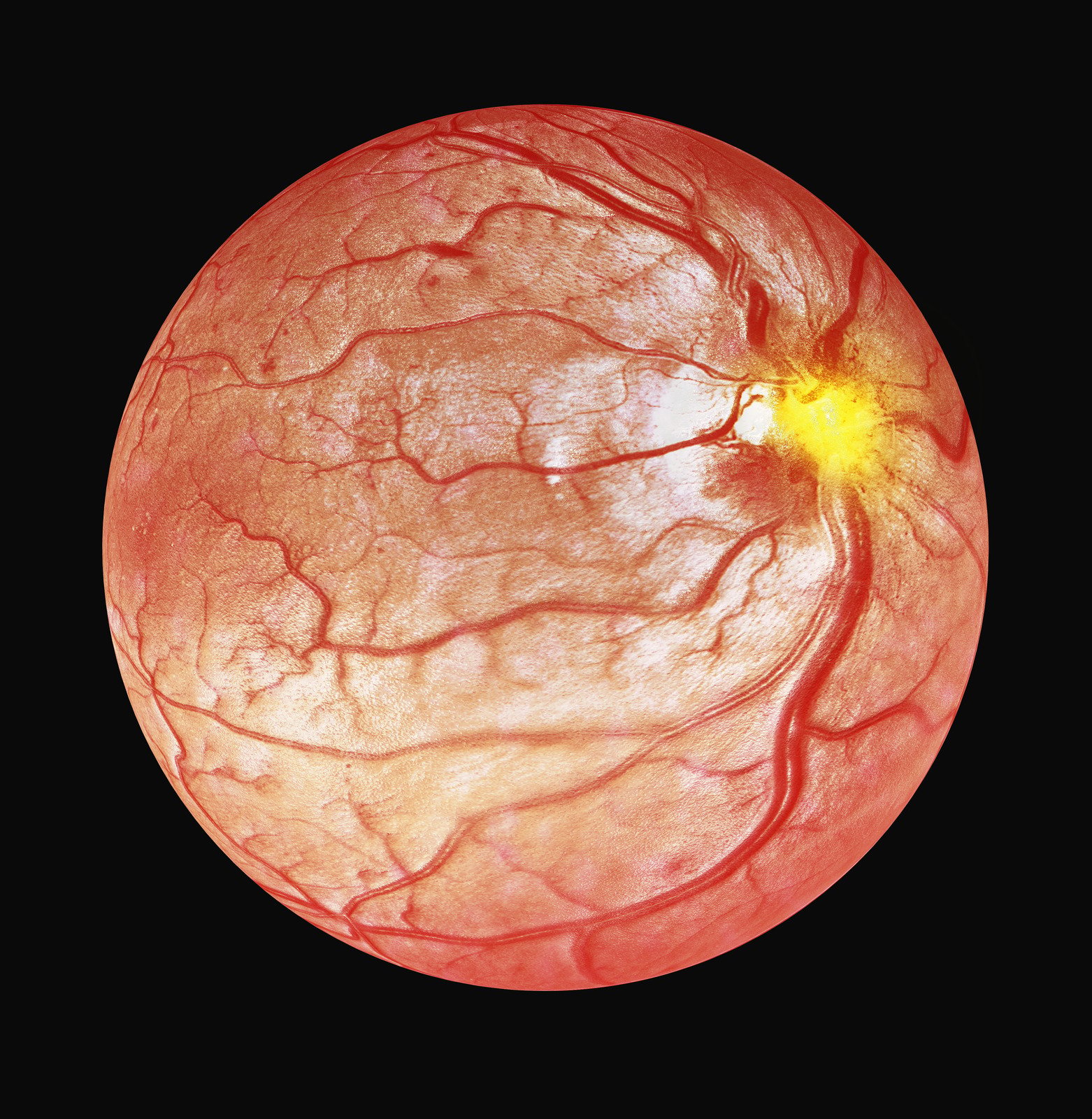 광간섭 단층 촬영 (OCT, Optical Coherence Tomography)