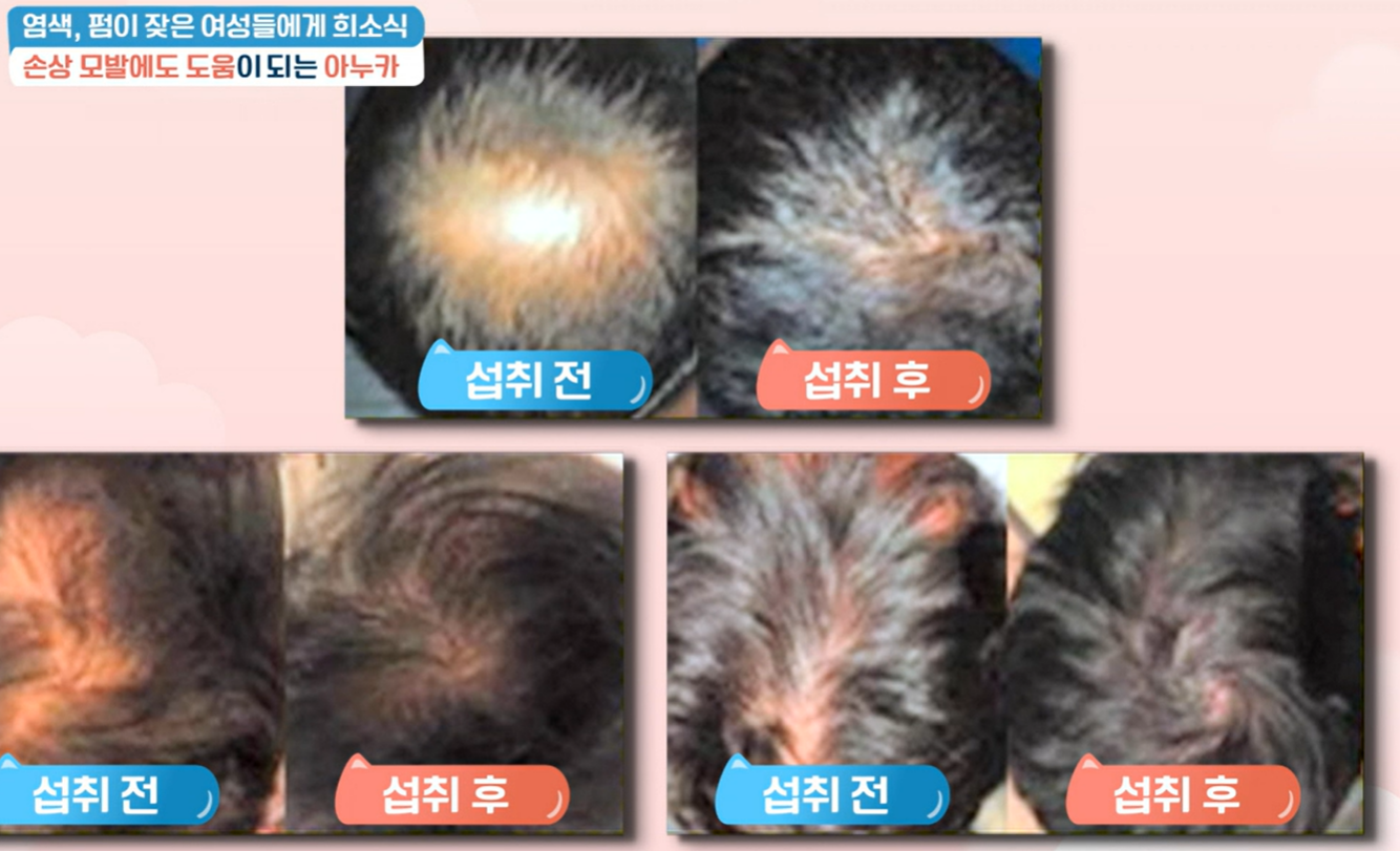 아누카사과 효능