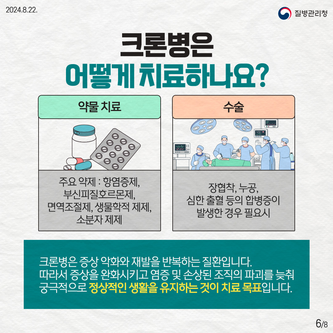 크론병 치료 이미지