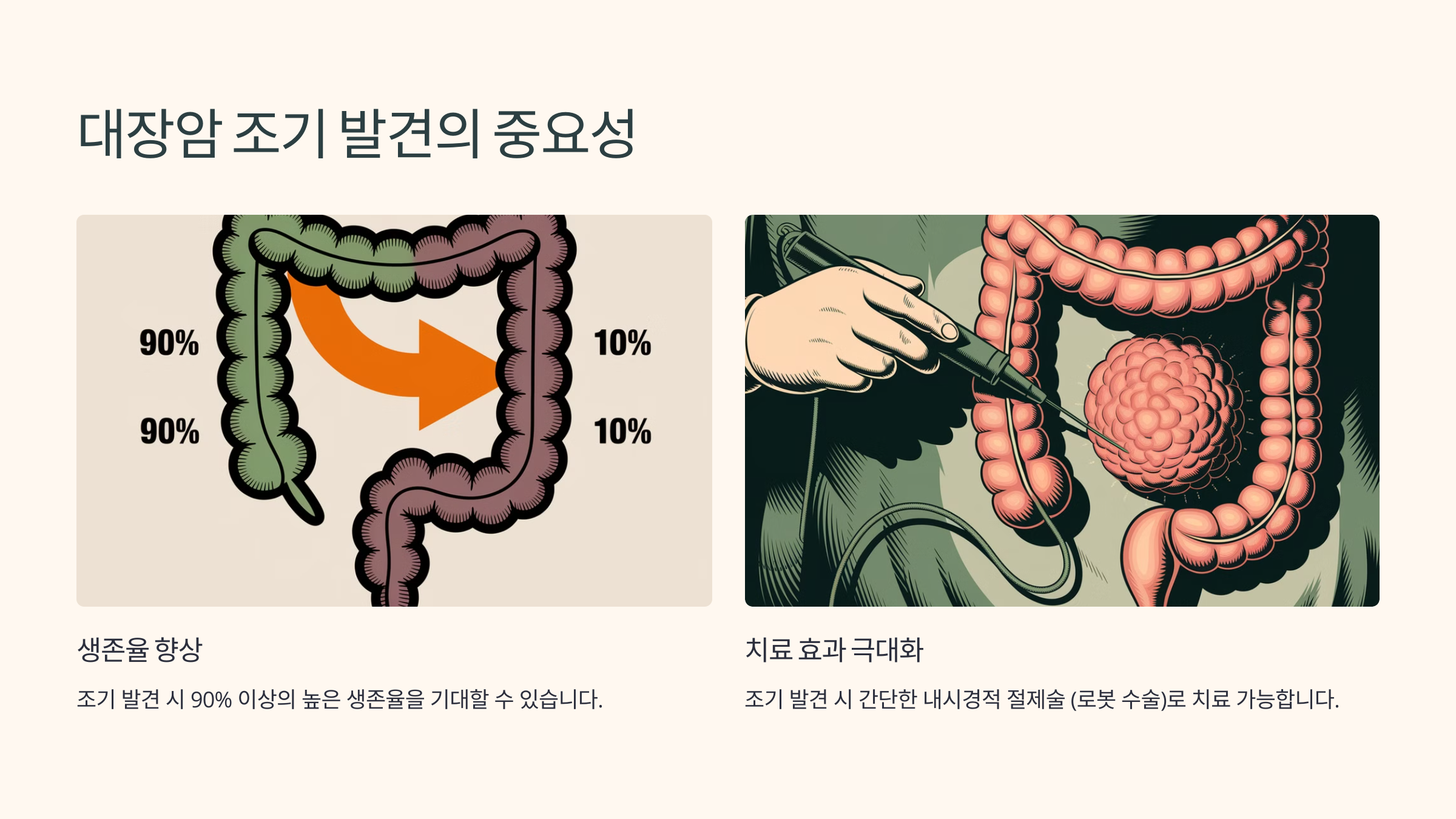 대장암 조기 발견의 중요성
