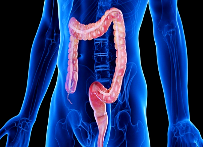 과민성 대장증후군 증상과 생활 관리법