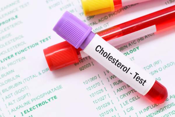 triglycerides 정상 수치