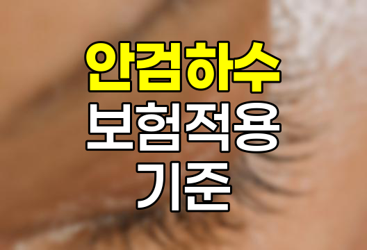 안검하수 보험 적용 기준과 수술 비용 안내