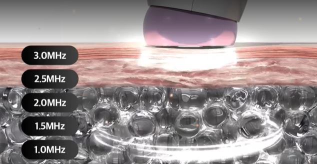 듀얼소닉-맥시멈-효과