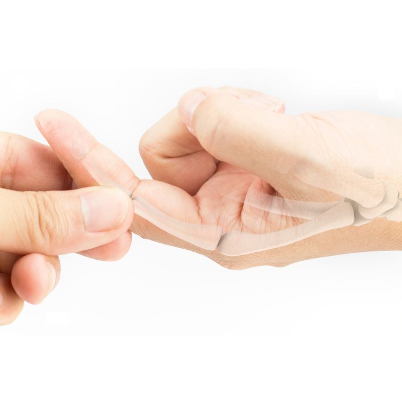 방아쇠수지증후군