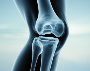 무릎 통증 원인
