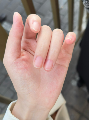 아세톤 리무버&amp;#44; 메니큐어 버리는 법 어떻게 해야 하는지 알려드림