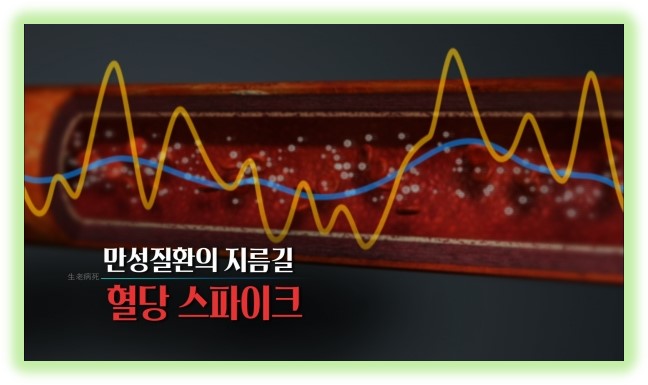 혈당스파이크