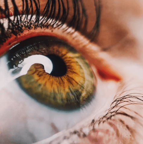 녹내장 초기증상 - 급성과 만성