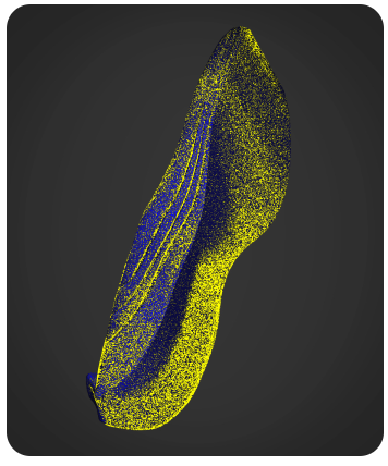 씨메스는 3D 비전