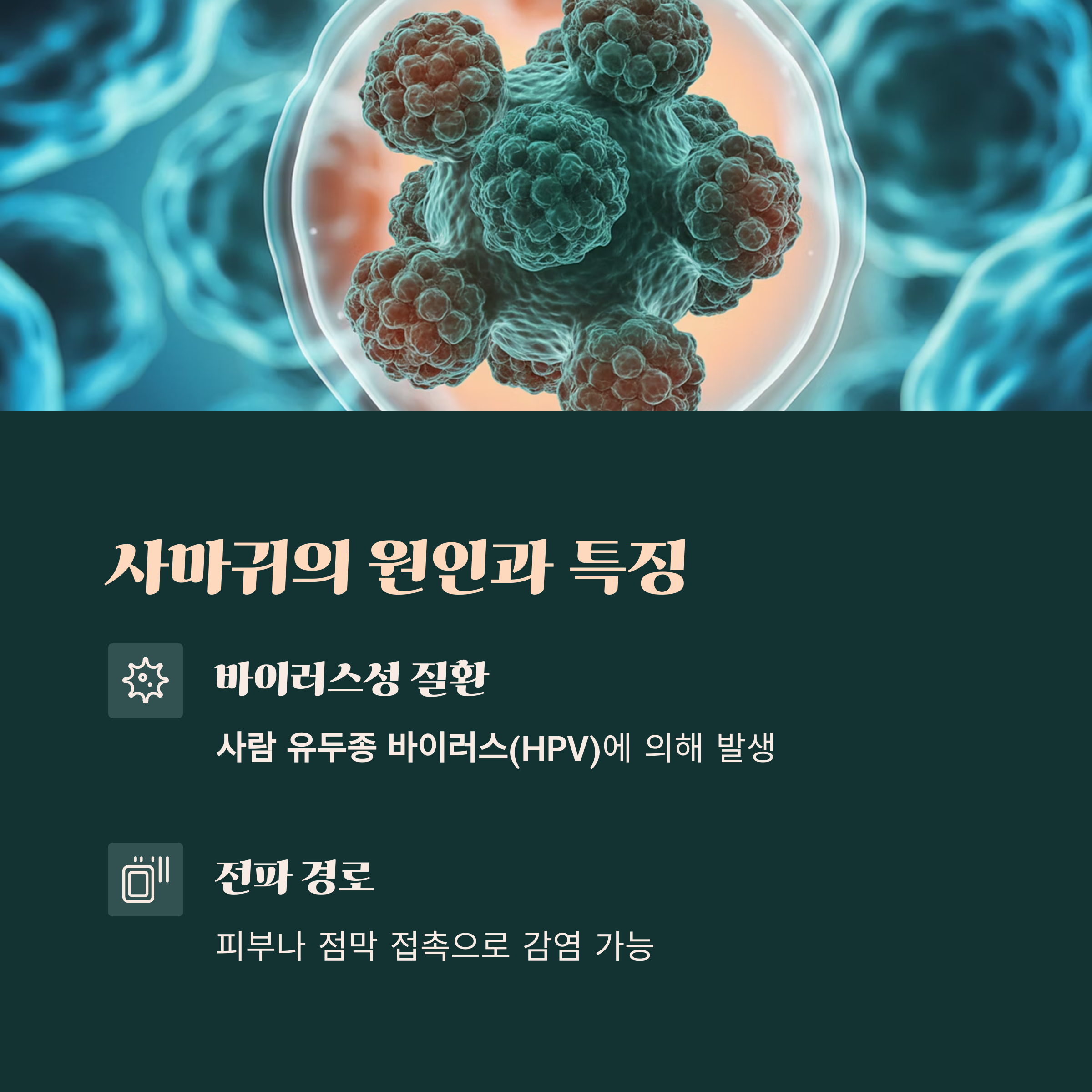 사람 유두종 바이러스(HPV)의 3D 렌더링 이미지 위로 '사마귀의 원인과 특징'을 설명하는 텍스트가 있는 교육용 이미지