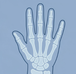 손가락 마디 통증