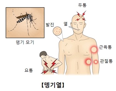 뎅기열