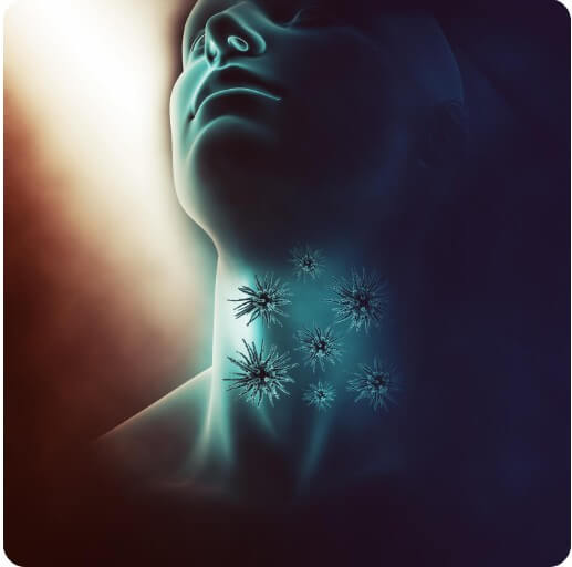 갑상선암의 위치와 암세균 번식하는 모습