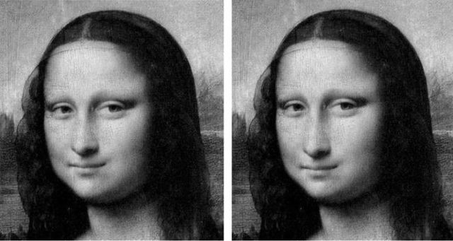 성형을 멈추지 못하는 이유